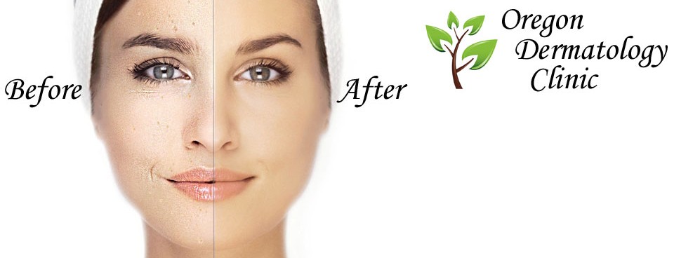Natural Skin Care Portland Oregon Natural Skin Care Portland Oregon